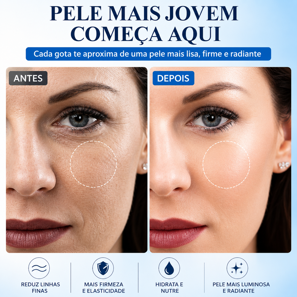 Comparação antes e depois do uso do Derma Lift